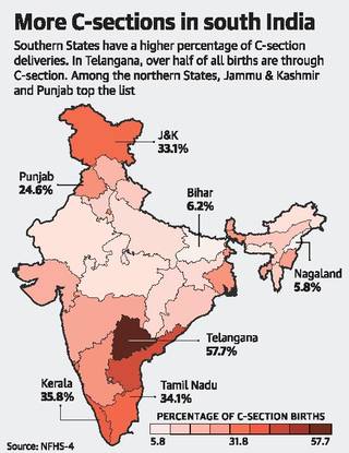 C Sections